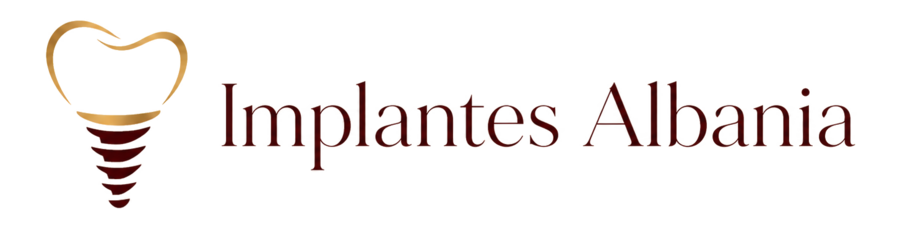 Implantes Albania